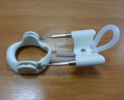 Extender after an appointment surgery
