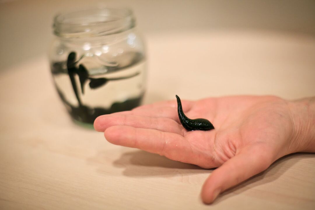 Leeches will serve as raw material for the production of a cream that stimulates the growth of the penis